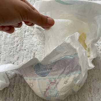 Molfix Junior Size 5 Diaper Defect Caused Red Spots and Itching