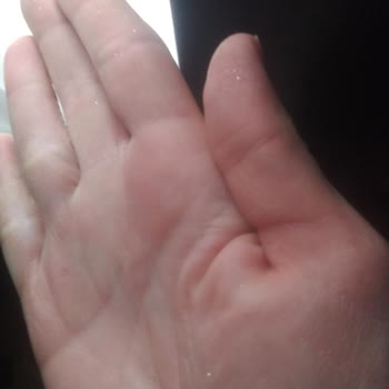 Simli Çocuk Ürününde Sağlık Riski Ve İade Talebi