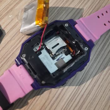 Çocuk Saatinin Bataryası Patladı, Güvenlik Riski Oluştu