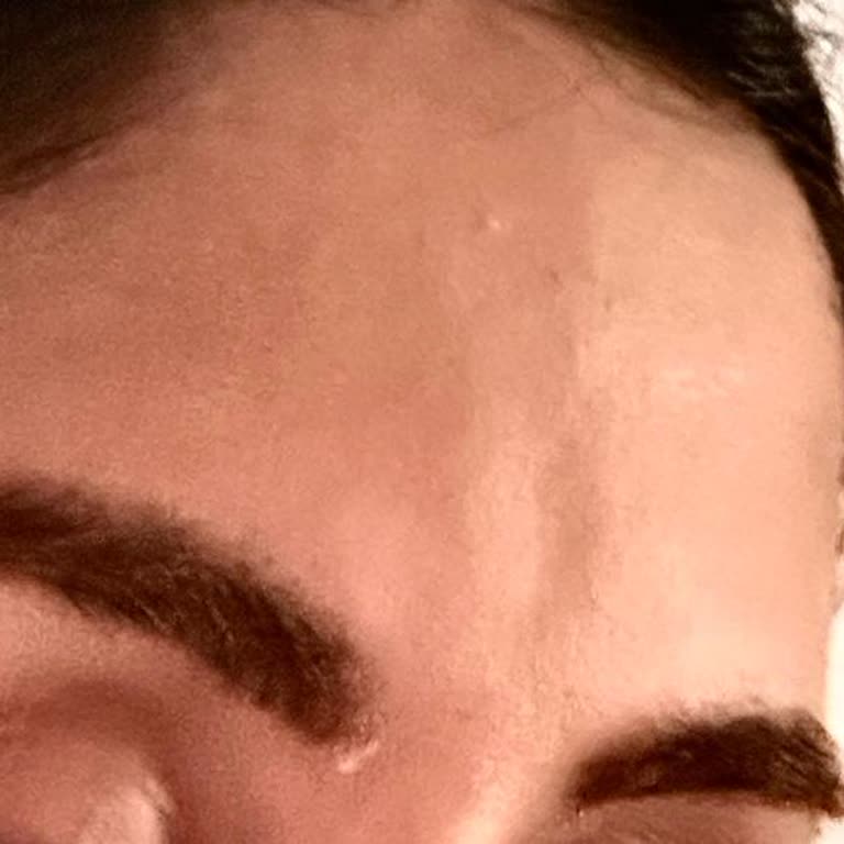 Yanıltıcı Bilgilendirme Ve Eksik Uygulama Nedeniyle Mağduriyet