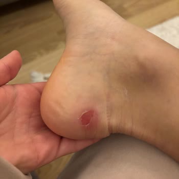 Aldığım Bot İlk Giyişte Ayağımı Yaraladı İade Talebim Reddedildi