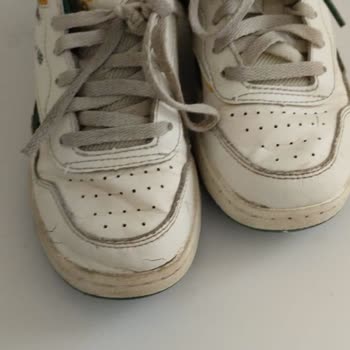 Kısa Sürede Deforme Olan Ayakkabıda İade Ve Değişim Yapılmıyor