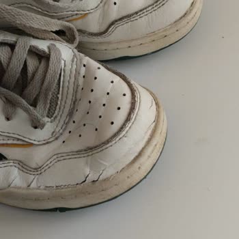 Kısa Sürede Deforme Olan Ayakkabıda İade Ve Değişim Yapılmıyor