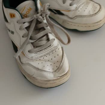 Kısa Sürede Deforme Olan Ayakkabıda İade Ve Değişim Yapılmıyor