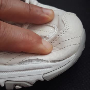 Pointspor Taban Ve Deri Kısmın Birleştiği Yerden Çatlama Ve Yırtılmalar Oluştu