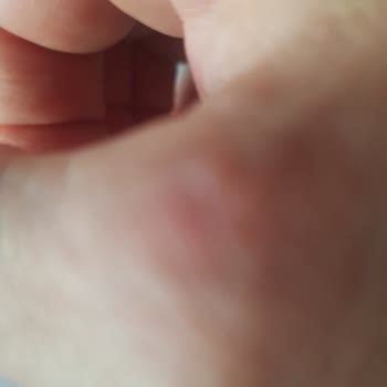 Dyson V11 Süpürge Aşırı Isınma Ve Servis Sorunu