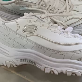 Skechers Ayakkabıda Renk Farkı Ve Çatlama Sorunu Yaşadım