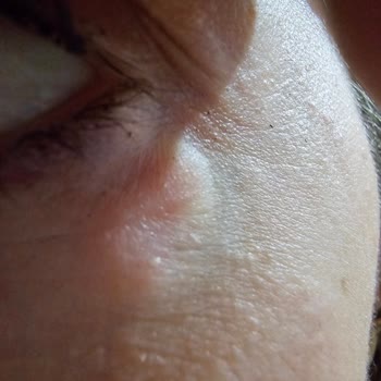 Solicito reembolso por reacción alérgica con crema de ojos Estee Lauder