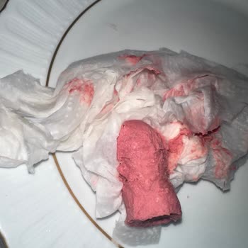 Tarihi Geçmemiş Sosis Bozuk Çıktı, Sağlığım Tehlikeye Girdi