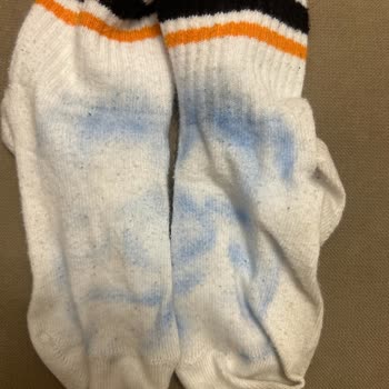 Bir Kez Giyilen Çocuk Ayakkabısında Boya Çıkması Ve Red Edilen İnceleme Talebi