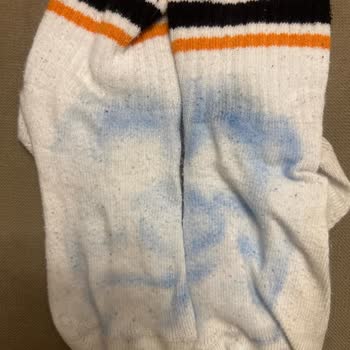 Bir Kez Giyilen Çocuk Ayakkabısında Boya Çıkması Ve Red Edilen İnceleme Talebi