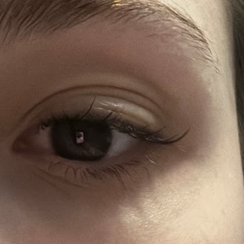 Kötü Hizmet, İlgisiz Çalışanlar Ve Başarısız İşlemlerle Mağdur Oldum