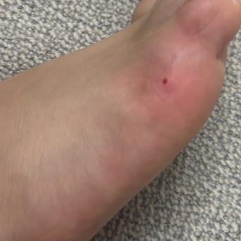 Yeni Alınan Koltuk Takımında Sürekli Sorunlar Ve Hayal Kırıklığı