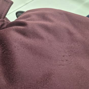 Hiç Giymediğim Mantoda Deformasyon Ve Mağazada Suçlayıcı Tavırla Karşılaştım