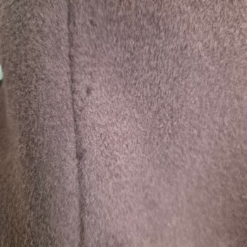 Hiç Giymediğim Mantoda Deformasyon Ve Mağazada Suçlayıcı Tavırla Karşılaştım