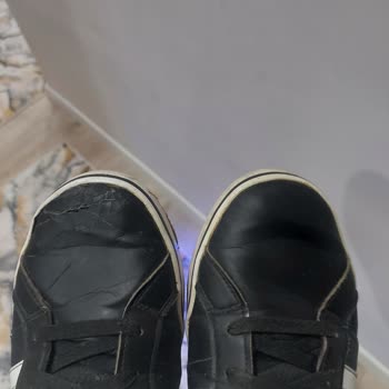 Aynı Çiftte Tek Ayakkabıda Çatlama Ve Deri Kalkması Sorunu Yaşadım