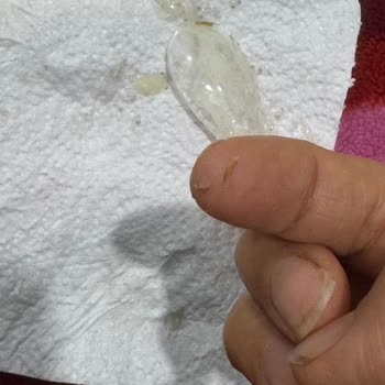 Bebek Mamasında Yabancı Madde Tehlikesi Yaşadık