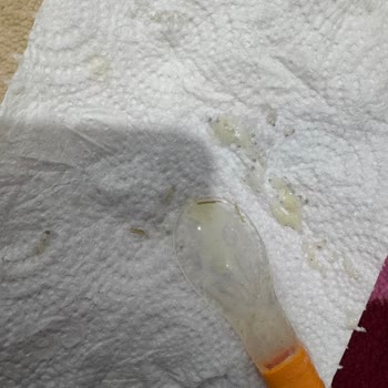 Bebek Mamasında Yabancı Madde Tehlikesi Yaşadık