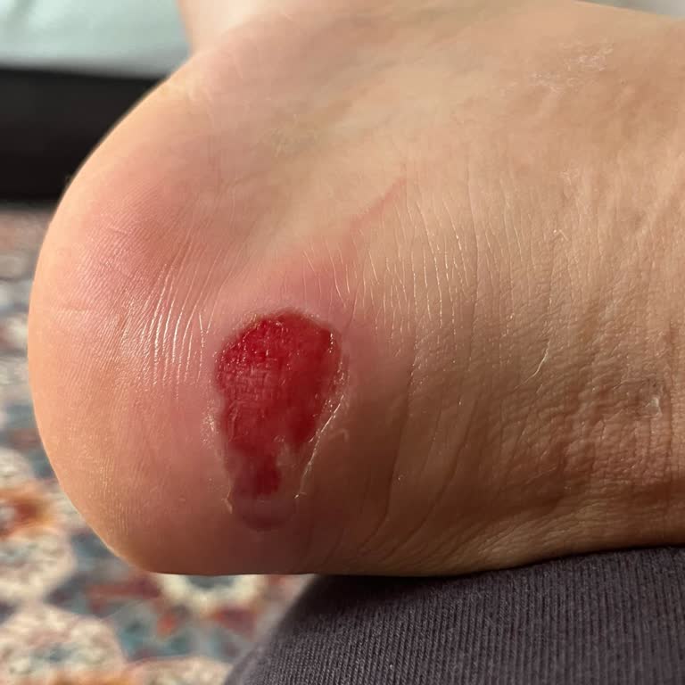 Derimod'dan Satın Alınan Bot Ayağımda Ciddi Yaralanmaya Sebep Oldu