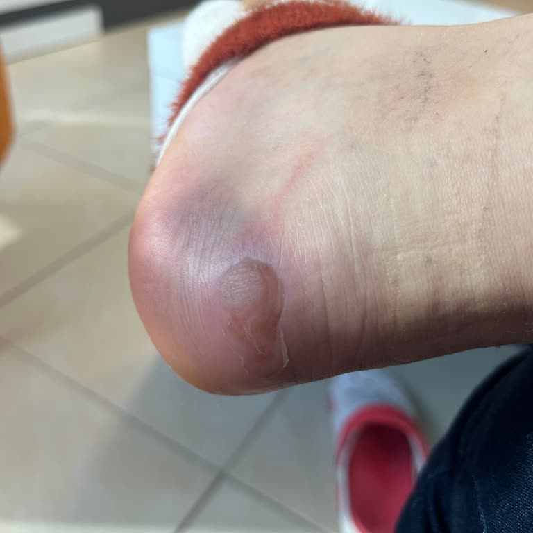 Derimod'dan Satın Alınan Bot Ayağımda Ciddi Yaralanmaya Sebep Oldu