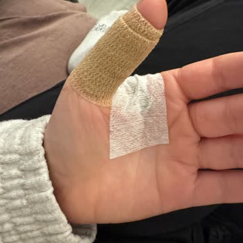 Cam Yağdanlık Aniden Patladı, Elim Kesildi Ve Güvenlik Endişesi Yaşadım