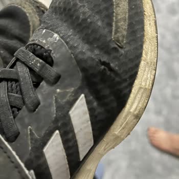 Kısa Sürede Deforme Olan Adidas Çocuk Ayakkabısında Mağduriyet Ve Yetersiz Müşteri Desteği