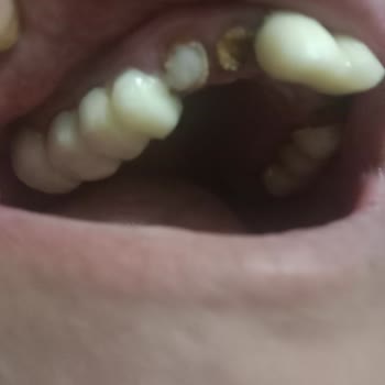 Geçici Dişler Hazırlanmadı, Mağdur Edildim