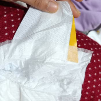 Molfix Bebek Bezinde Üretim Hatası Ve Güven Kaybı