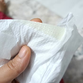 Molfix Bebek Bezinde Üretim Hatası Ve Güven Kaybı