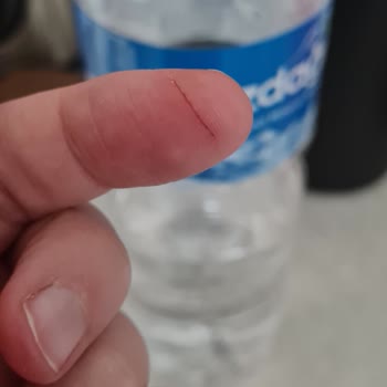 Buzdağı Şişe Suyu Açmaya Çalışırken Parmağım Kesildi