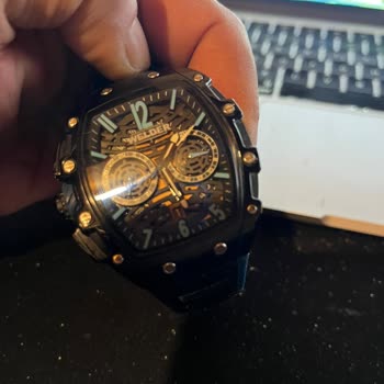 Garanti Süresi Devam Eden Saatimin Kordonundaki Deformasyon Kullanıcı Hatası Sayıldı