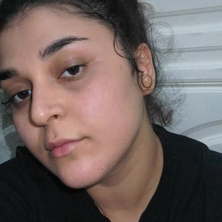 Neutrogena Yüz Temizleme Jeli Yüzümde Yanma ve İz Oluşturdu