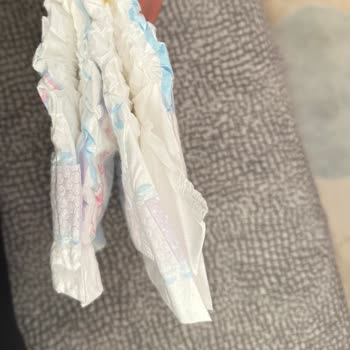 Aynı Seri Molfix Bezlerde Boyut Ve Baskı Farkları Şaşırtıyor