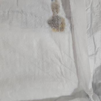 Bebek Bezinde Yabancı Madde Ve Taşırma Sorunu Yaşadım