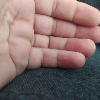 Kelebek Mobilya Novardy Koltuk Takımında Kumaş Sorunu Ve Yetersiz Müşteri Hizmeti