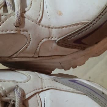 FLO Ayakkabı Üstünden Derisi Yırtıldı