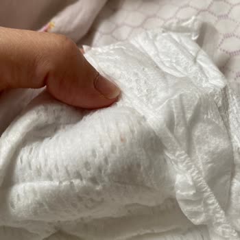 Bebek Bezinde Yabancı Cisim Ve Güven Sorunu