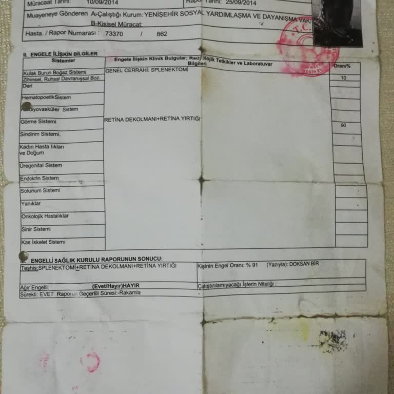 Engelli Raporu İndirimi Bir Türlü Tanımlanmıyor, Mağdur Ediliyorum