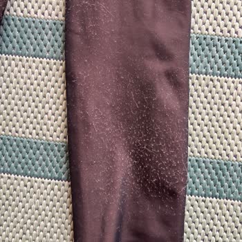 İlk Kullanımda Deforme Olan Çorap Ve Yetersiz Müşteri Desteği