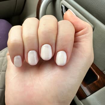 Jel Tırnak İşleminden Sonra Mağduriyet Ve İlgisiz Müşteri Hizmetleri