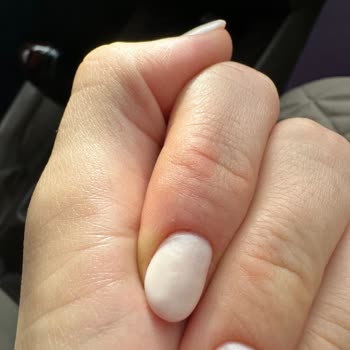 Jel Tırnak İşleminden Sonra Mağduriyet Ve İlgisiz Müşteri Hizmetleri