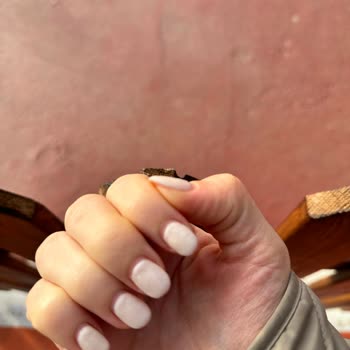 Jel Tırnak İşleminden Sonra Mağduriyet Ve İlgisiz Müşteri Hizmetleri