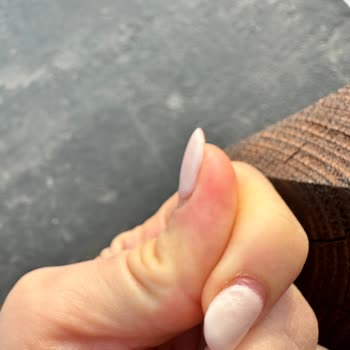 Jel Tırnak İşleminden Sonra Mağduriyet Ve İlgisiz Müşteri Hizmetleri