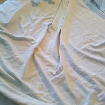 Adıyaman Gölbaşı Devlet Hastanesi'nde Yetersiz Temizlik Ve İlgisiz Personel