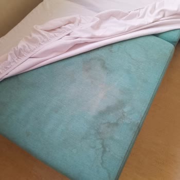 Adıyaman Gölbaşı Devlet Hastanesi'nde Yetersiz Temizlik Ve İlgisiz Personel