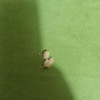 Zeki Gıda Pirinç Paketinde Yabancı Madde: Sağlık ve Güvenlik Endişesi