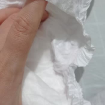 Sleepy Bebek Bezinde Pembe Boya Lekeleriyle Karşılaştım, Güvenim Sarsıldı