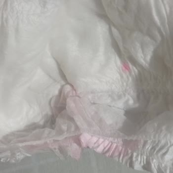 Sleepy Bebek Bezinde Pembe Boya Lekeleriyle Karşılaştım, Güvenim Sarsıldı