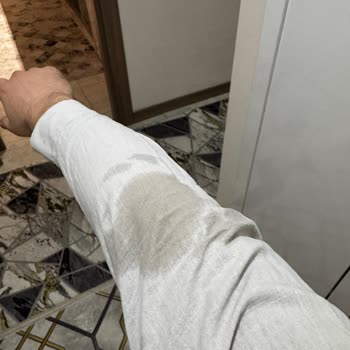 Su Geçirmez Mont Yağmurda Su Aldı, Teknik Rapor Ve İade Talebim Karşılanmadı