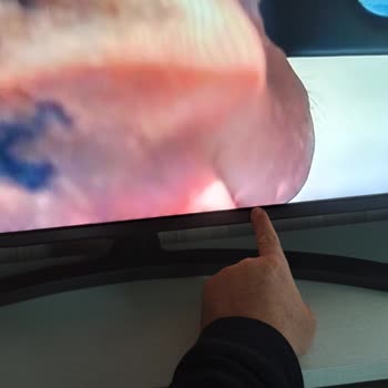 Yetkili Servis Güvensizliği Ve Çözülmeyen LG Televizyon Sorunu